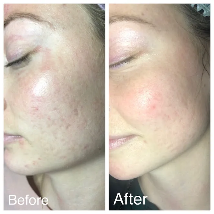 Luna Bella Skin Care Picture 5