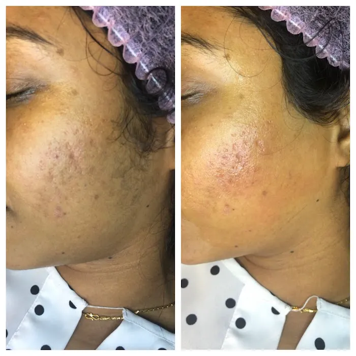 Luna Bella Skin Care Picture 2