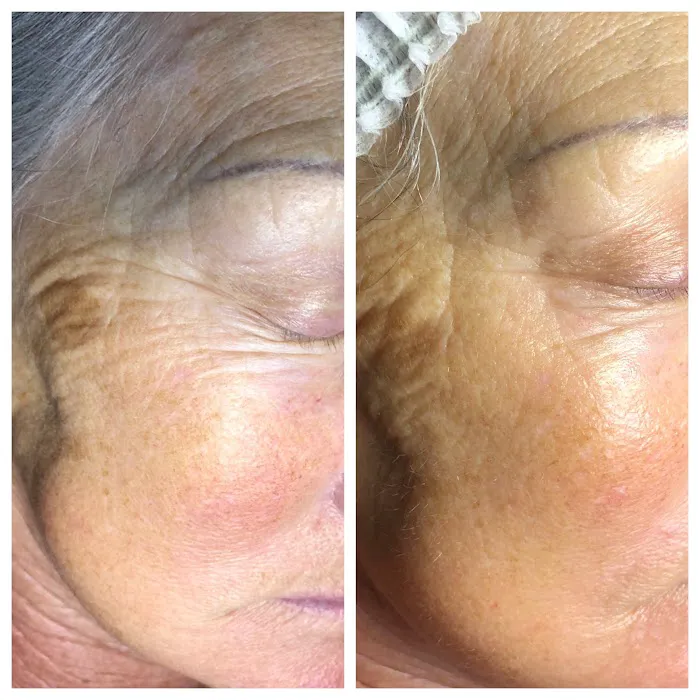 Luna Bella Skin Care Picture 3