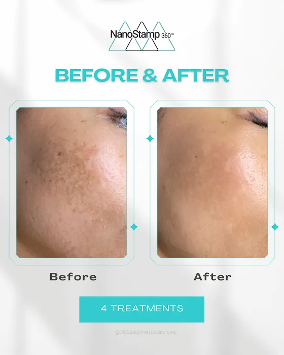DeRomano Skincare Picture 5