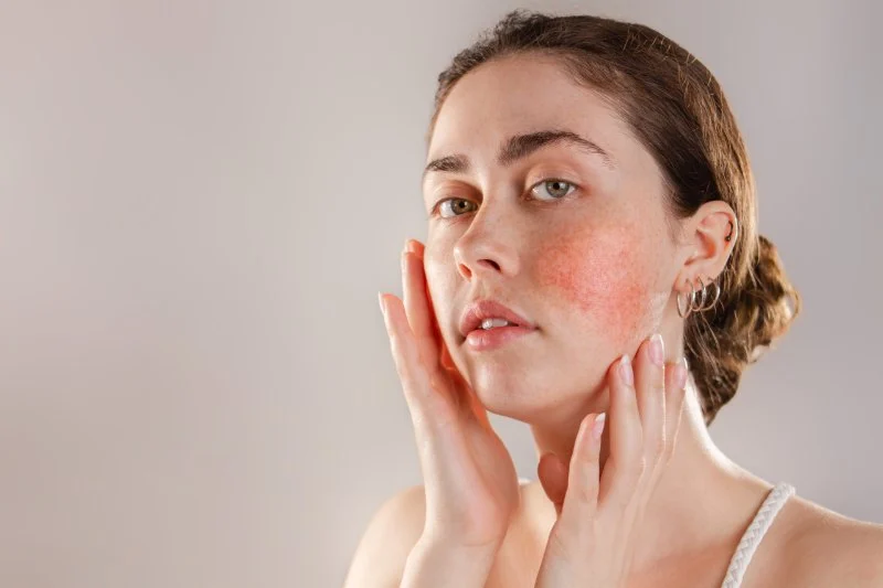 How To Avoid Sensitive Skin: What You Need To Know for Healthier Skin