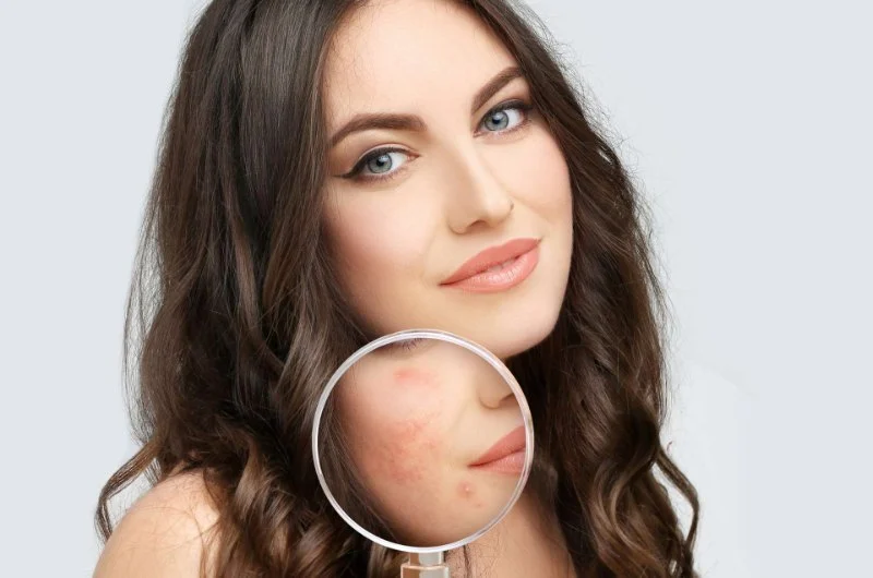 How To Detoxify Your Scars With These 7 Proven Tips