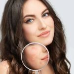 How To Detoxify Your Scars With These 7 Proven Tips