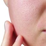 Skin Care Tips for Facial Oils That Help Improve Large Pores