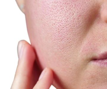 Skin Care Tips for Facial Oils That Help Improve Large Pores