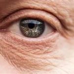 Top Tips for Fine Lines in Women: How to Manage and Reduce Them