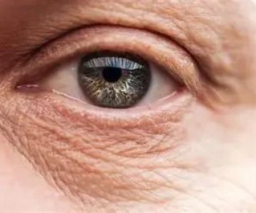 Top Tips for Fine Lines in Women: How to Manage and Reduce Them