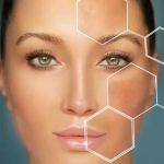 Understanding Sun Damage For Women: Causes, Effects, and Prevention Tips