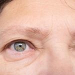 Expert Advice on Puffy Eyes in People Over 40 – Causes and Solutions