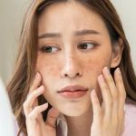 Best Skin Care Routine for Uneven Skin Tone Effectively