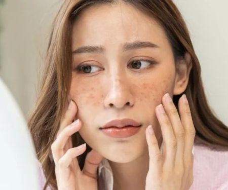 Best Skin Care Routine for Uneven Skin Tone Effectively