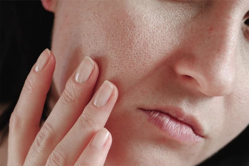 How to Boost Your Skin's Large Pores: Tips and Techniques for Clearer Skin