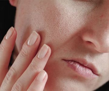 How to Boost Your Skin's Large Pores: Tips and Techniques for Clearer Skin