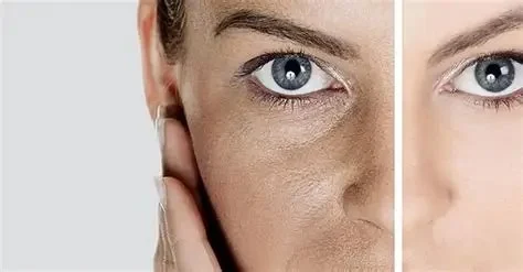 Best Products for Dull Skin: What You Need to Know