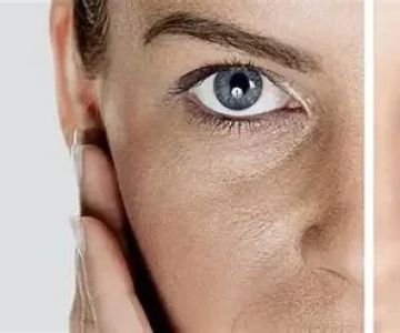 Best Products for Dull Skin: What You Need to Know