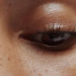 How To Prevent Your Dark Circles With These 7 Tips | SkinCare Experts