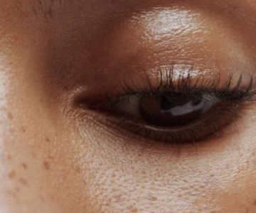 How To Prevent Your Dark Circles With These 7 Tips | SkinCare Experts