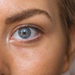 Best Products for Acne and How to Manage It – Complete Guide