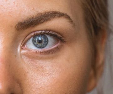 Best Products for Acne and How to Manage It – Complete Guide