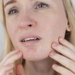 How To Treat Dry Skin: What You Need To Know