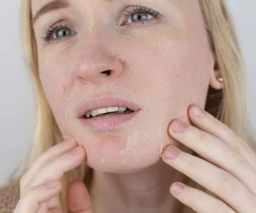 How To Treat Dry Skin: What You Need To Know