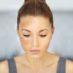 Best Products for Hyperpigmentation Using Natural Remedies