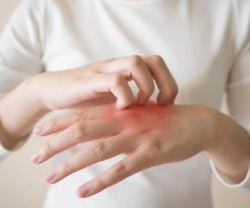 Skin Care Tips For Eczema: What You Need To Know