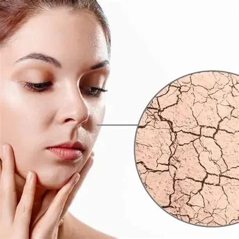 Effective Ways to Improve Your Dry Skin with These 12 Tips