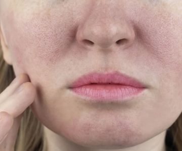 How to Boost Your Skin’s Large Pores: What You Need to Know