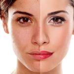 Natural Remedies For Your Age Spots With These 7 Tips