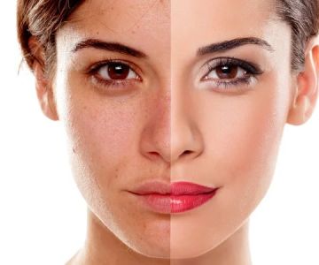 Natural Remedies For Your Age Spots With These 7 Tips