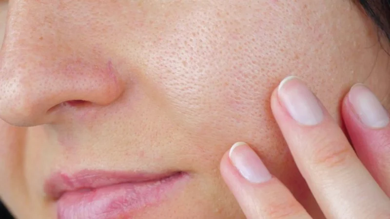 How To Embrace Large Pores: Expert Advice on Texture, Products, and Real Skin