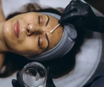 Best Ingredients For Sun Damage Relief for Athletes - Top Ingredients & Tips