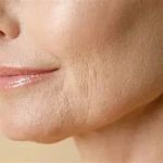 How To Get Rid Of Fine Lines With A Simple Routine: Effective Skin Care Tips