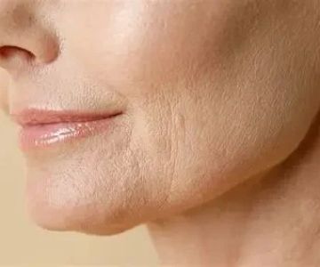 How To Get Rid Of Fine Lines With A Simple Routine: Effective Skin Care Tips