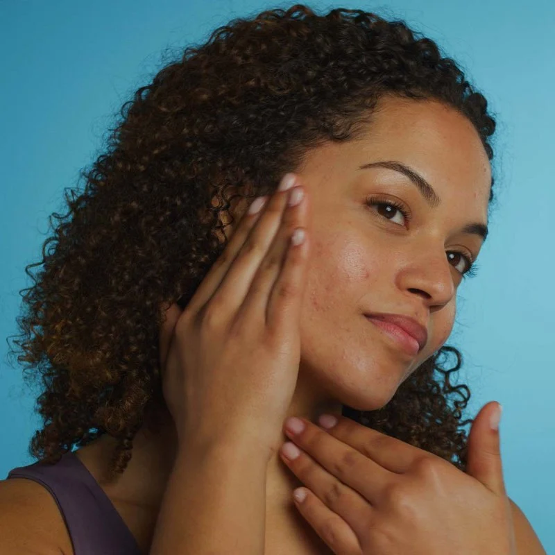How To Treat Acne And How To Manage It – SkinCare Experts