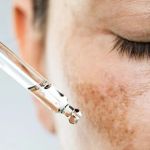 How to Heal Hyperpigmentation and How to Manage It Effectively