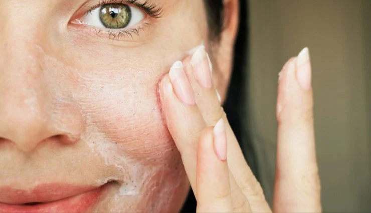 How to Deal with Oily Skin Effectively