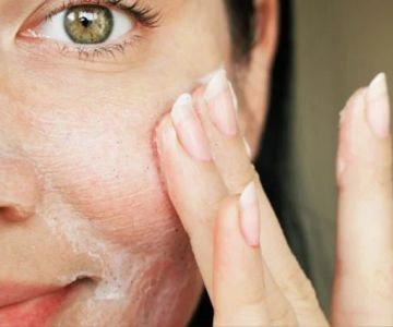 How to Deal with Oily Skin Effectively