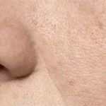 Best Ingredients for Large Pores – Effective Solutions and Expert Tips