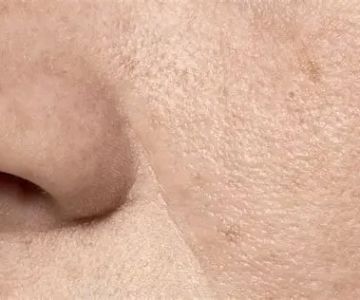 Best Ingredients for Large Pores – Effective Solutions and Expert Tips