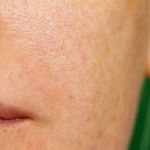 How To Deal With Your Large Pores With These 15 Expert Tips