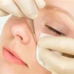 The Ultimate Guide to Skin Care Treatments for Blackheads