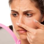 Best Practices for Whiteheads with a Simple Skincare Routine