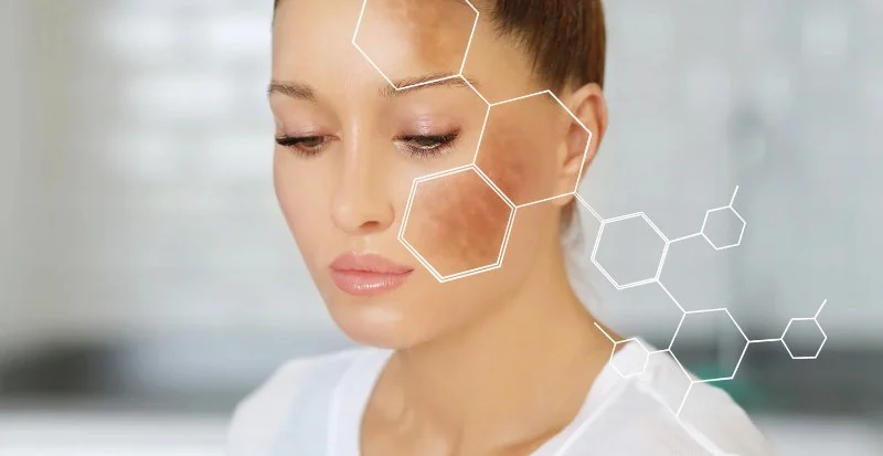 How To Balance Hyperpigmentation for Athletes According to Experts