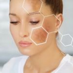 How To Balance Hyperpigmentation for Athletes According to Experts