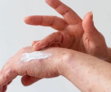 Expert Advice On Eczema For People With Combination Skin