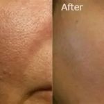 Best Products For Large Pores Using Natural Remedies