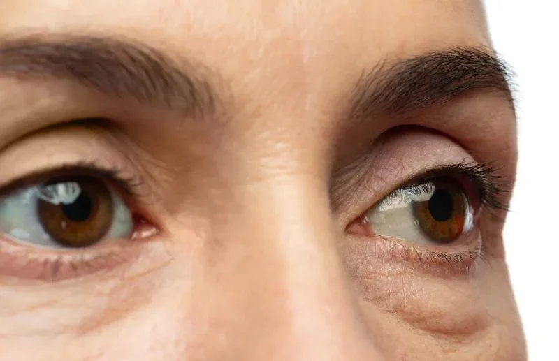 How To Achieve Puffy Eyes With A Simple Routine