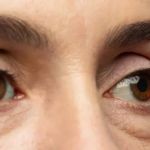 How To Achieve Puffy Eyes With A Simple Routine